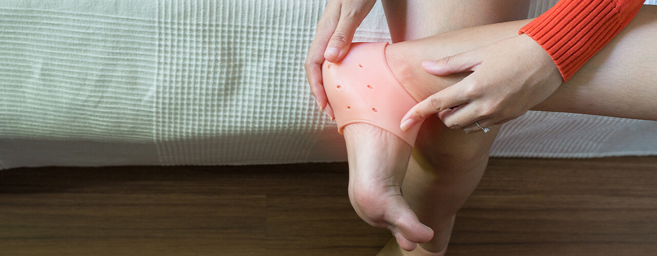 plantar fasciitis