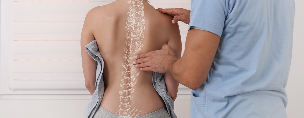 Scoliosis