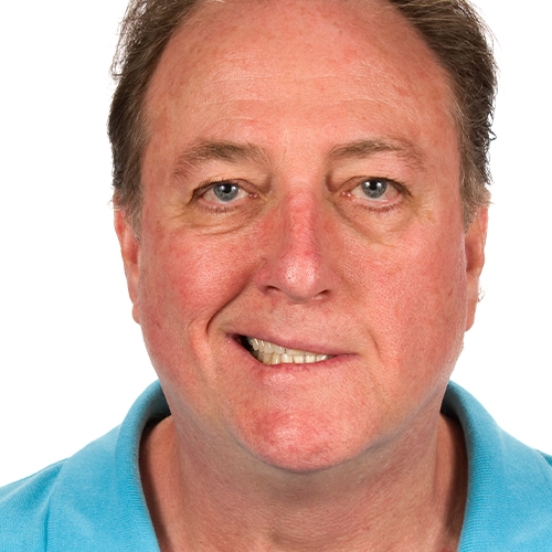 bells-palsy-Peninsula-Physical-Therapy-And-Aquatic-Rehabilitation-Hampton-VA