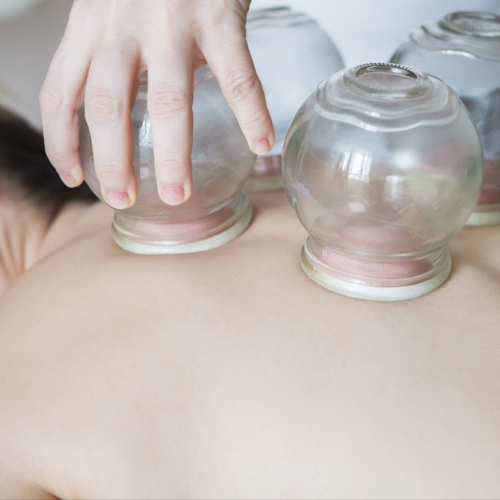 cupping-Peninsula-Physical-Therapy-And-Aquatic-Rehabilitation-Hampton-VA